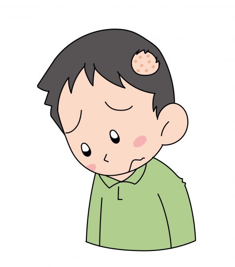 育毛 無料イラスト素材ならイラストック