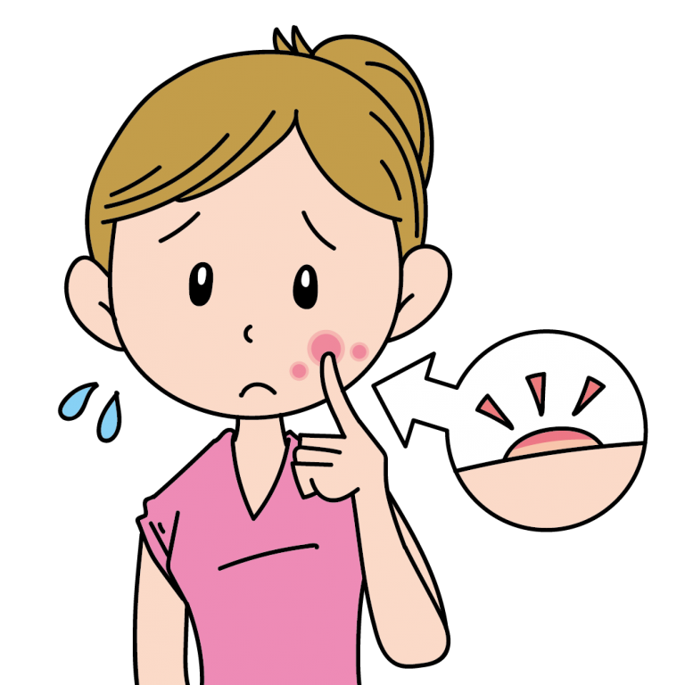 ニキビが出来て困っている女性 無料イラスト素材ならイラストック